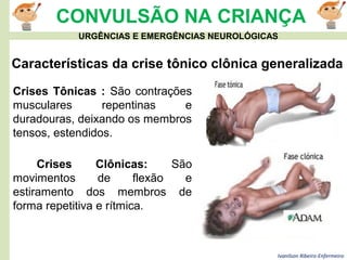 Ivanilson Ribeiro-Enfermeiro
CONVULSÃO NA CRIANÇA
Características da crise tônico clônica generalizada
Crises Tônicas : São contrações
musculares repentinas e
duradouras, deixando os membros
tensos, estendidos.
URGÊNCIAS E EMERGÊNCIAS NEUROLÓGICAS
Crises Clônicas: São
movimentos de flexão e
estiramento dos membros de
forma repetitiva e rítmica.
 