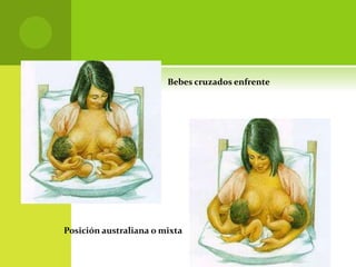 Bebes cruzados enfrente
Posición australiana o mixta
 