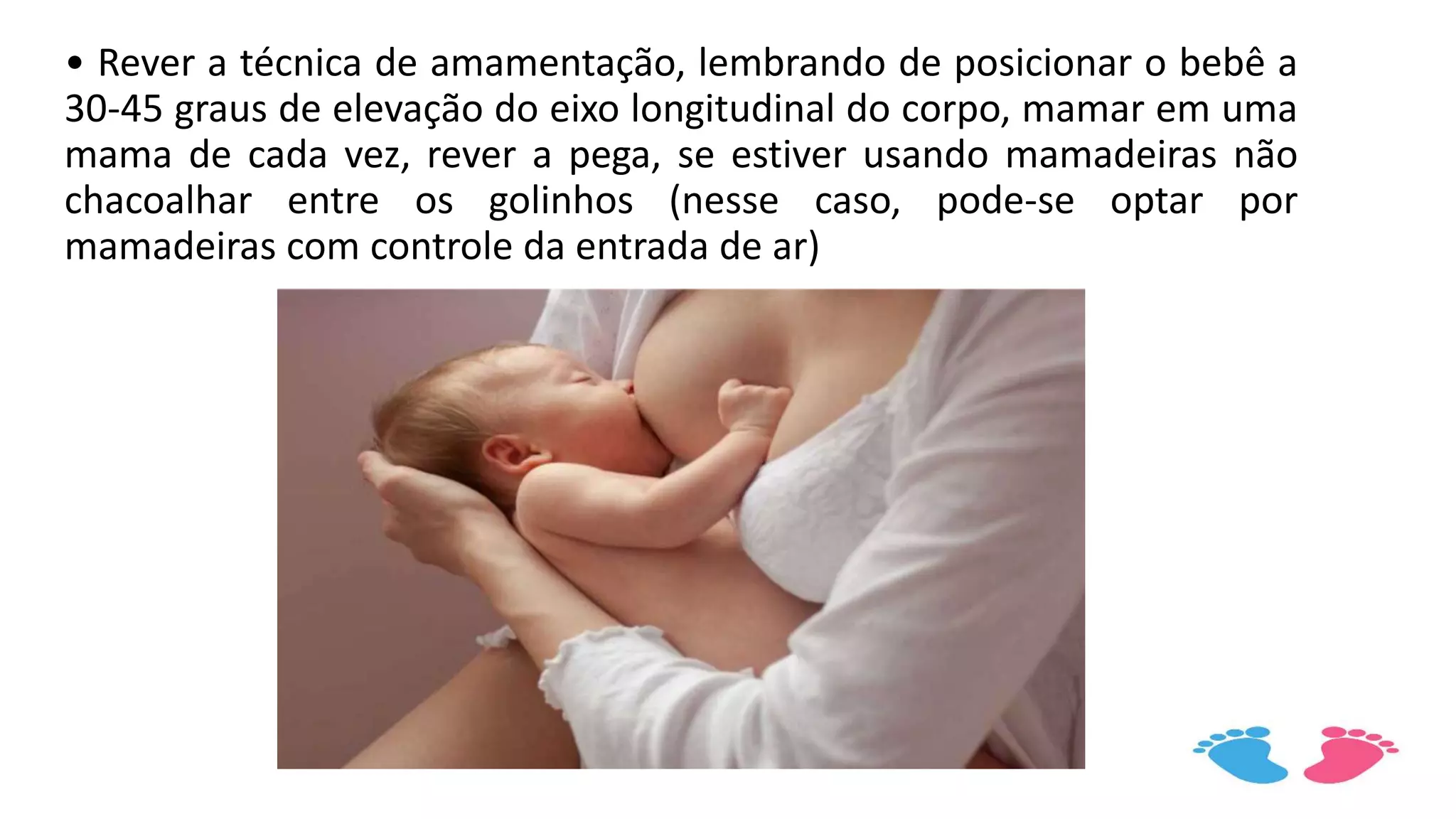 • Rever a técnica de amamentação, lembrando de posicionar o bebê a
30-45 graus de elevação do eixo longitudinal do corpo, mamar em uma
mama de cada vez, rever a pega, se estiver usando mamadeiras não
chacoalhar entre os golinhos (nesse caso, pode-se optar por
mamadeiras com controle da entrada de ar)
 