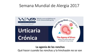 Semana Mundial de Alergia 2017
La agonía de las ronchas
Qué hacer cuando las ronchas y la hinchazón no se van
Urticaria
Crónica
 
