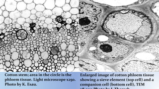 Enlarged image of cotton phloem tissue
showing a sieve element (top cell) and a
companion cell (bottom cell), TEM
Cotton stem; area in the circle is the
phloem tissue. Light microscope x250.
Photo by K. Esau.
 