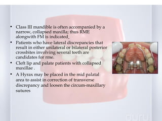 early treatment of class III malocclusion | PPT