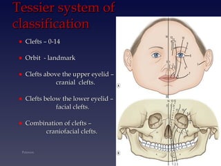 cleft lip and palate part 1 | PPT