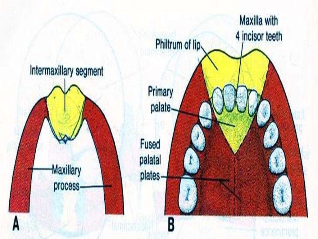 cleft lip and palate part 1