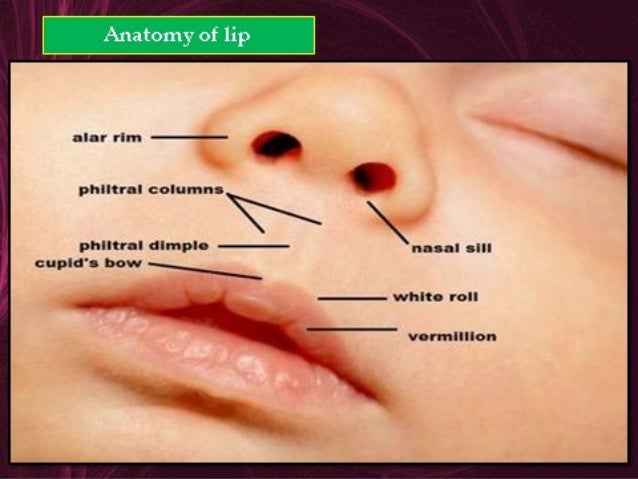 cleft lip and palate part 1