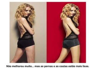 Não melhorou muito... mas as pernas e as costas estão mais lisas. 