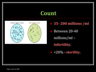 Count
 35- 200 millions /ml
 Between 20-40
millions/ml –
infertility.
 <20% - sterility.
Friday, June 19, 2020
 