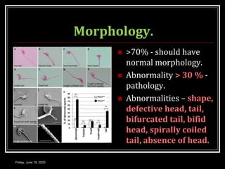Morphology.
 >70% - should have
normal morphology.
 Abnormality > 30 % -
pathology.
 Abnormalities – shape,
defective head, tail,
bifurcated tail, bifid
head, spirally coiled
tail, absence of head.
Friday, June 19, 2020
 