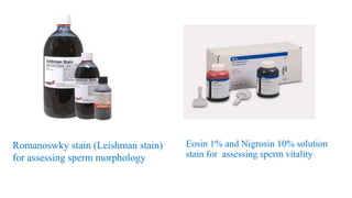 Eosin 1% and Nigrosin 10% solution
stain for assessing sperm vitality
Romanoswky stain (Leishman stain)
for assessing sperm morphology
 