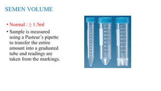 SEMEN VOLUME
• Normal : ≥ 1.5ml
• Sample is measured
using a Pasteur’s pipette
to transfer the entire
amount into a graduated
tube and readings are
taken from the markings.
 