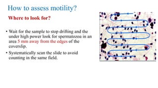 How to assess motility?
Where to look for?
• Wait for the sample to stop drifting and the
under high power look for spermatozoa in an
area 5 mm away from the edges of the
coverslip.
• Systematically scan the slide to avoid
counting in the same field.
 