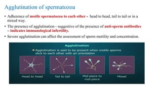 Agglutination of spermatozoa
• Adherence of motile spermatozoa to each other - head to head, tail to tail or in a
mixed way.
• The presence of agglutination - suggestive of the presence of anti-sperm antibodies
– indicates immunological infertility.
• Severe agglutination can affect the assessment of sperm motility and concentration.
 