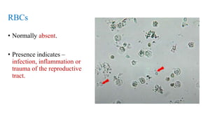 RBCs
• Normally absent.
• Presence indicates –
infection, inflammation or
trauma of the reproductive
tract.
 