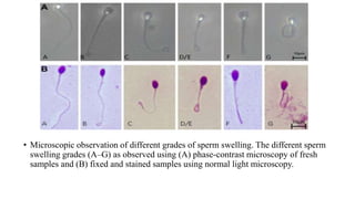 • Microscopic observation of different grades of sperm swelling. The different sperm
swelling grades (A–G) as observed using (A) phase-contrast microscopy of fresh
samples and (B) fixed and stained samples using normal light microscopy.
 