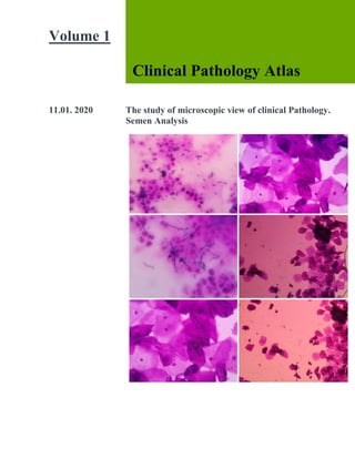 1
Volume 1
Clinical Pathology Atlas
11.01. 2020 The study of microscopic view of clinical Pathology.
Semen Analysis
 