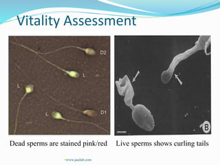 Vitality Assessment
Dead sperms are stained pink/red Live sperms shows curling tails
www.jaailab.com
 