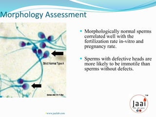 Morphology Assessment
 Morphologically normal sperms
correlated well with the
fertilization rate in-vitro and
pregnancy rate.
 Sperms with defective heads are
more likely to be immotile than
sperms without defects.
www.jaailab.com
 