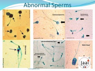 Abnormal Sperms
www.jaailab.com
 
