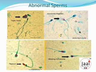 Abnormal Sperms
1 2
43
www.jaailab.com
 
