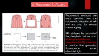 3. Fluorometric Assays
Fluorometric methods are
more sensitive than the
colorimetric detection of AP
and are used for semen
stain mapping.
AP catalyzes the removal of
the phosphate residue on a
4-methylumbelliferone
phosphate (MUP) substrate,
a reaction that generates
fluorescence under
ultraviolet light.
 