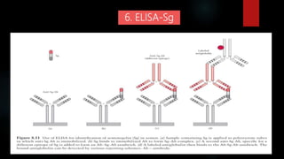 6. ELISA-Sg
 