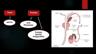 .
Testes
sperms
Prostate
Acid
Phospatase
Prostate
Specific
Antigen(PSA)
 