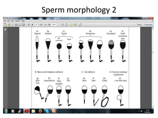 Sperm morphology 2
 