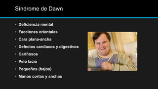 Síndrome de Dawn
• Deficiencia mental
• Facciones orientales
• Cara plana-ancha
• Defectos cardiacos y digestivos
• Cariñosos
• Pelo lacio
• Pequeños (bajos)
• Manos cortas y anchas
 