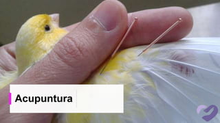 Acupuntura
 