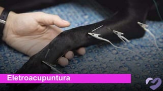 Eletroacupuntura
 