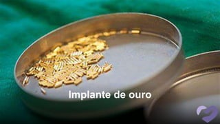 Implante de ouro
 