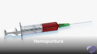 Hemopuntura
 