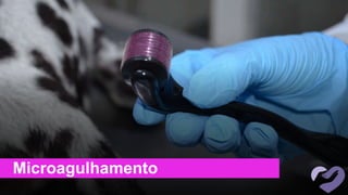 Microagulhamento
 