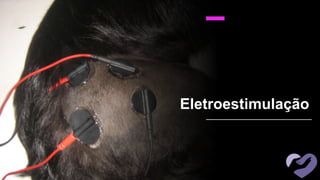 Eletroestimulação
 