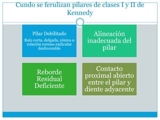 Cundo se ferulizan pilares de clases I y II de
Kennedy
Pilar Debilitado
Raíz corta, delgada, cónica o
relación corono-radicular
desfavorable
Alineación
inadecuada del
pilar
Reborde
Residual
Deficiente
Contacto
proximal abierto
entre el pilar y
diente adyacente
 