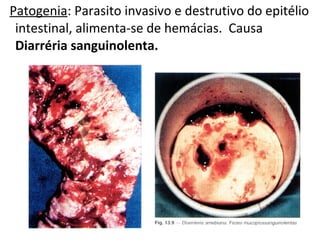 Patogenia: Parasito invasivo e destrutivo do epitélio
intestinal, alimenta-se de hemácias. Causa
Diarréria sanguinolenta.
 