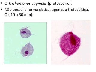 • O Trichomonas vaginalis (protozoário).
• Não possui a forma cística, apenas a trofozoítica.
O ( 10 a 30 mm).
 