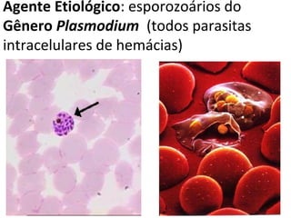 Agente Etiológico: esporozoários do
Gênero Plasmodium (todos parasitas
intracelulares de hemácias)
 