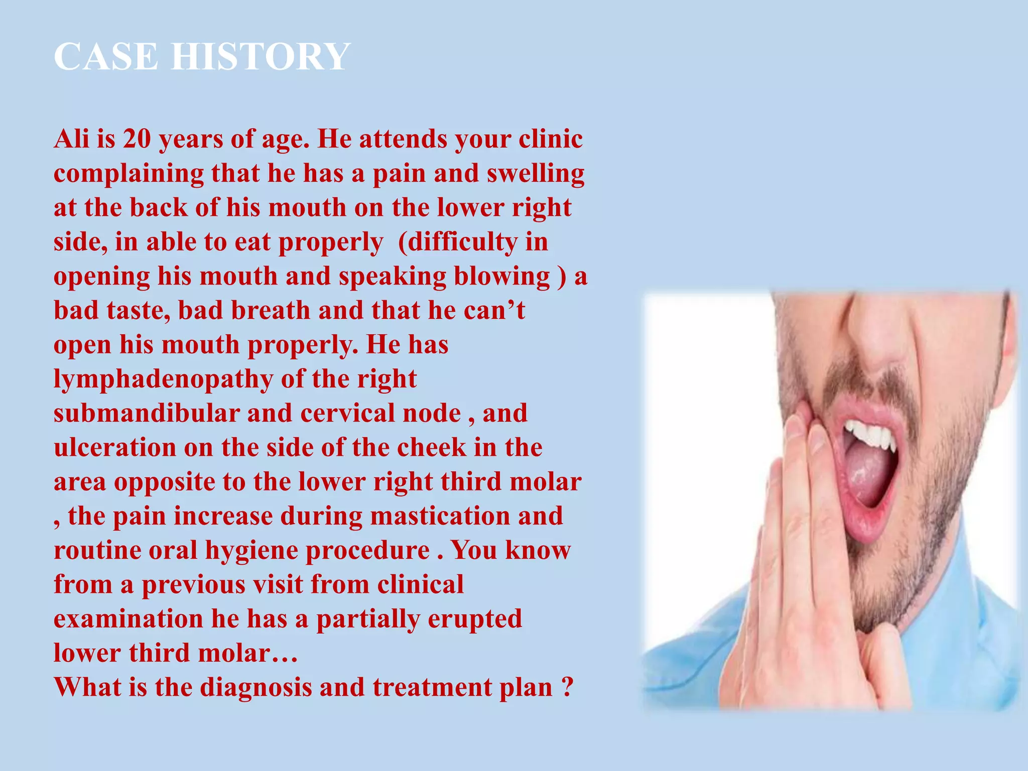 Pericoronitis PPT