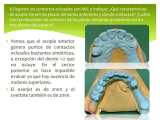  Vemos que el acople anterior
genera puntos de contactos
oclusales bastantes simétricos,
a excepción del diente 1.2 que
no ocluye. En el sector
posterior se hace imposible
evaluar ya que hay ausencia de
molares superiores.
 El overjet es de 2mm y el
overbite también es de 2mm.
8.Registre los contactos oclusales yen MIC e Indique: ¿Qué características
de acople tienen las piezas dentarias anteriores y donde contactan? ¿Cuáles
son las relaciones de contacto de las piezas dentarias posteriores en los
tres planos del espacio?
 