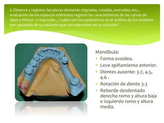 Mandíbula:
 Forma ovoidea.
 Leve apiñamiento anterior.
 Dientes ausente: 3.7, 4.5,
4.6 .
 Rotación de diente 3.3
 Reborde desdentado
derecho romo y altura baja
e izquierdo romo y altura
media.
6.Observe y registre: las piezas dentarias migradas, rotadas, extruidas, etc.,
evaluación de los espacios edéntulos registre las características de las curvas de
Spee y Wilson y responda: ¿ Cuáles son los parámetros en el análisis de los modelos
por separado de su paciente que son relevantes en su oclusión?
 