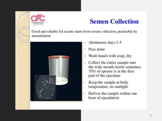 Seminal Uid Analysis Seminal fluid.pptx