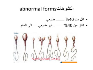 Seminal Uid Analysis Seminal fluid analysis | PPT