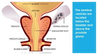 Seminal Graphics SEMINAL VESICLE presentation.pptx important for fertility | PPTX