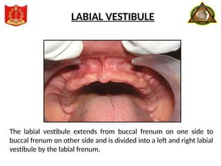 The labial vestibule extends from buccal frenum on one side to
buccal frenum on other side and is divided into a left and right labial
vestibule by the labial frenum.
LABIAL VESTIBULE
 