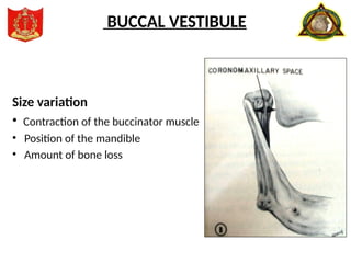 Size variation
• Contraction of the buccinator muscle
• Position of the mandible
• Amount of bone loss
BUCCAL VESTIBULE
 