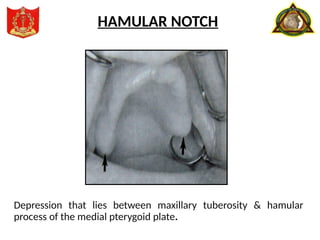 Depression that lies between maxillary tuberosity & hamular
process of the medial pterygoid plate.
HAMULAR NOTCH
 