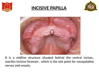 It is a midline structure situated behind the central incisor.,
overlies incisive foramen , which is the exit point for nasopalatine
nerves and vessels.
INCISIVE PAPILLA
 