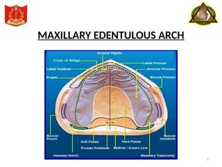7
MAXILLARY EDENTULOUS ARCH
 