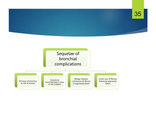 35
Sequelae of
bronchial
complications
Stricture of bronchus
at site of erosion
Cylindrical
bronchiectasis in area
of old collapse
Wedge shadow:
contracture & fibrosis
of segmental lesion
Linear scar of fibrosis
following segmental
lesion
 